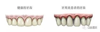 微博:澳彩资料免费资料大全-牙周炎是什么症状