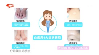 知乎：2o24澳门正版精准资料-白癜风有什么症状
