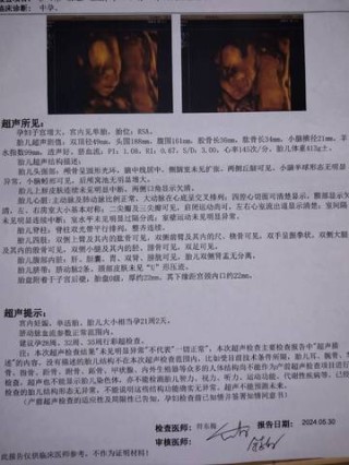 网易:澳门一肖一码一必开一肖-小康生活的标准是什么