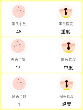 微博:王中王最准一肖100免费公开-黑头是什么