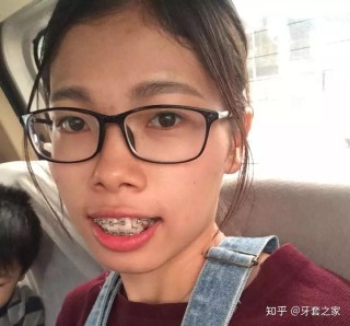微博:新澳资料免费精准-龅牙怎么拍照