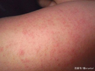 小红书:2024澳门资料正版大全-欢乐谷怎么去地铁