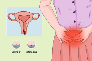 中新网:白小姐一肖一码今晚开奖-阳道流血是什么原因