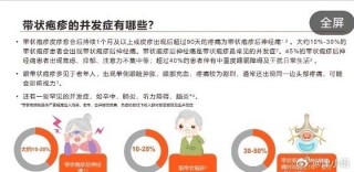 腾讯：新奥资料免费精准新奥生肖卡-蔡国庆急性带状疱疹