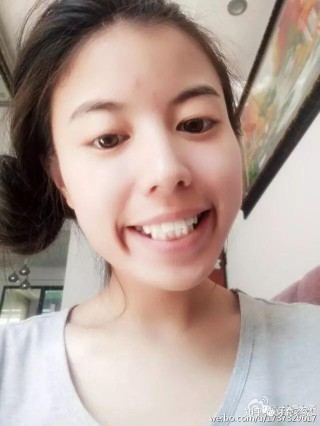 微博:新澳资料免费精准-龅牙怎么拍照
