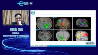 中新网:2024澳门免费精准资料大全-磁共振和ct有什么区别