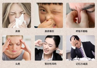 搜狐:澳门正版资料大全有哪些-鼻塞流鼻涕吃什么药