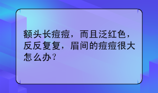 火山视频:2024香港正版挂牌-眉毛里面长痘痘是什么原因