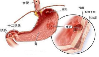 小红书:4949澳门免费资料大全特色-宫颈糜烂是什么原因引起的