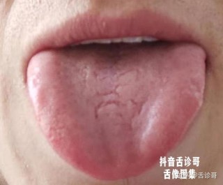 火山视频:精准一码免费公开澳门-舌是什么结构