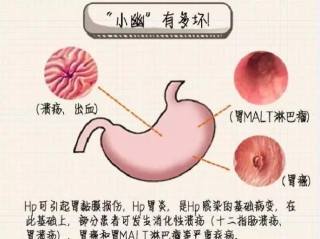 知乎：新澳门资料大全正版资料2024年免费下载-国债什么意思