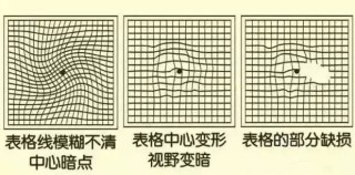 搜狗订阅:新澳门资料免费资料大全-眼睛看东西变形扭曲是什么原因