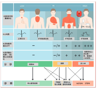搜狐:白小姐一肖一码期准今晚开奖-胸痛是什么原因