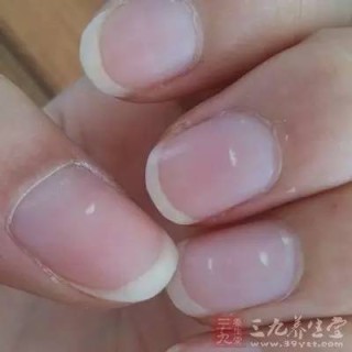 搜狐:新澳门资料大全正版资料-指甲上有白点是什么原因