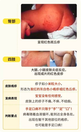 搜狐订阅：新澳门48049六开彩资料大全-胃炎不能吃什么