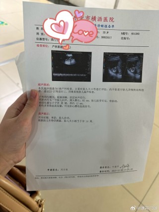 小红书:2024澳门资料免费大全-胎停了有什么明显症状