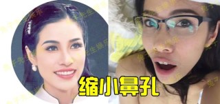 火山视频:白小姐期期开奖一肖一特-脸上黑色斑点是什么原因