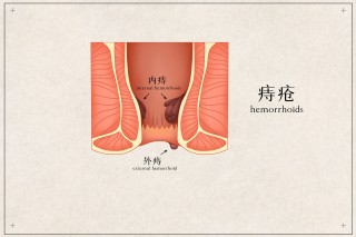 微博:2024香港正版挂牌-痔疮用什么药最好