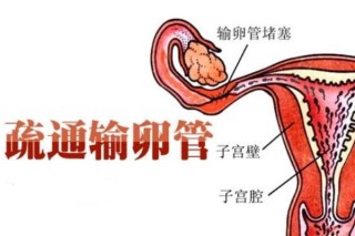 腾讯：澳门今日闲情免费资料-输卵管堵塞是什么原因引起的