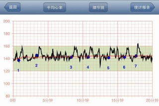 百度平台:澳门王中王100%期期中-胎心监护是检查什么