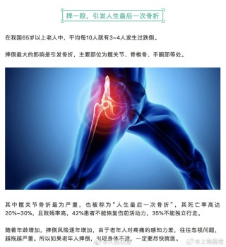 知乎：2024管家婆正版六肖料-什么睡姿对髋关节好