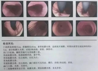 小红书:4949澳门免费资料大全特色-宫颈糜烂是什么原因引起的