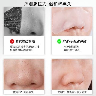 微博:王中王最准一肖100免费公开-黑头是什么