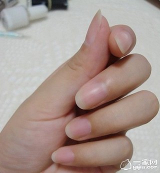 微博:马会澳门正版资料查询-指甲发黄是什么原因