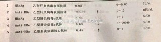 微博订阅:白小姐一肖一码今晚开奖-乙肝两对半245阳性是什么意思