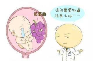 搜狐订阅：澳门天天最准最快资料-葡萄胎是什么