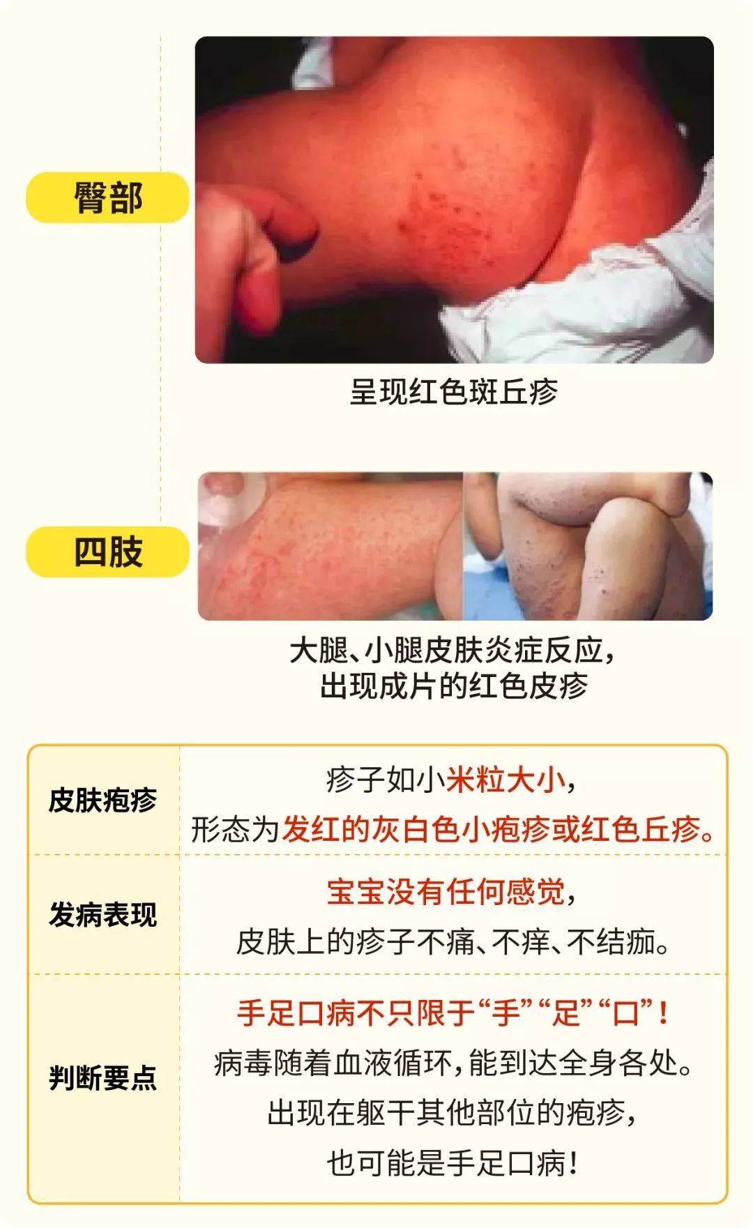 搜狐订阅：新澳门48049六开彩资料大全-胃炎不能吃什么