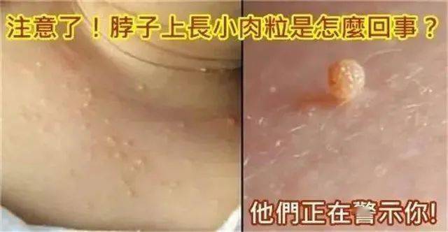 知乎：2O24澳彩管家婆资料传真-受凉喉咙痛吃什么药