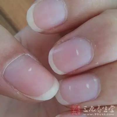 搜狐:新澳门资料大全正版资料-指甲上有白点是什么原因
