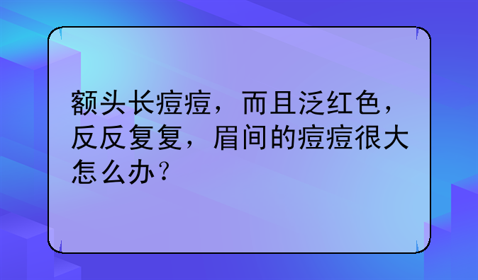火山视频:2024香港正版挂牌-眉毛里面长痘痘是什么原因