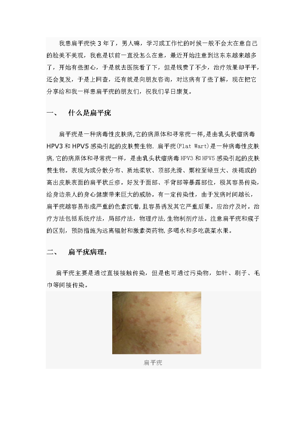 抖音视频:2024年正版资料免费大全-扁平疣用什么药膏管用