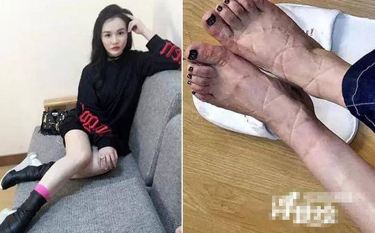 火山视频:香港内部公开资料最准下载-哪个女明星的脚最丑