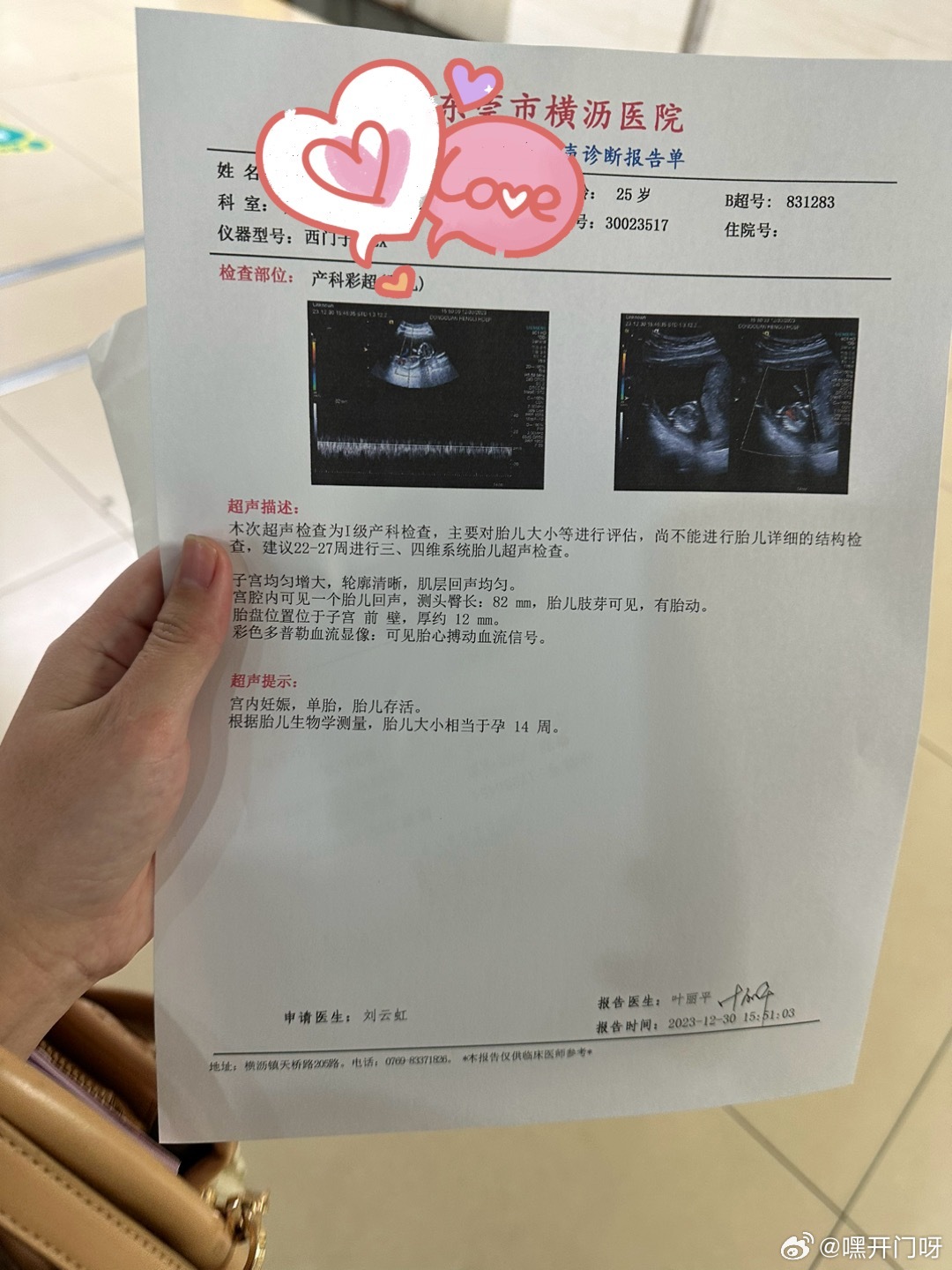小红书:2024澳门资料免费大全-胎停了有什么明显症状