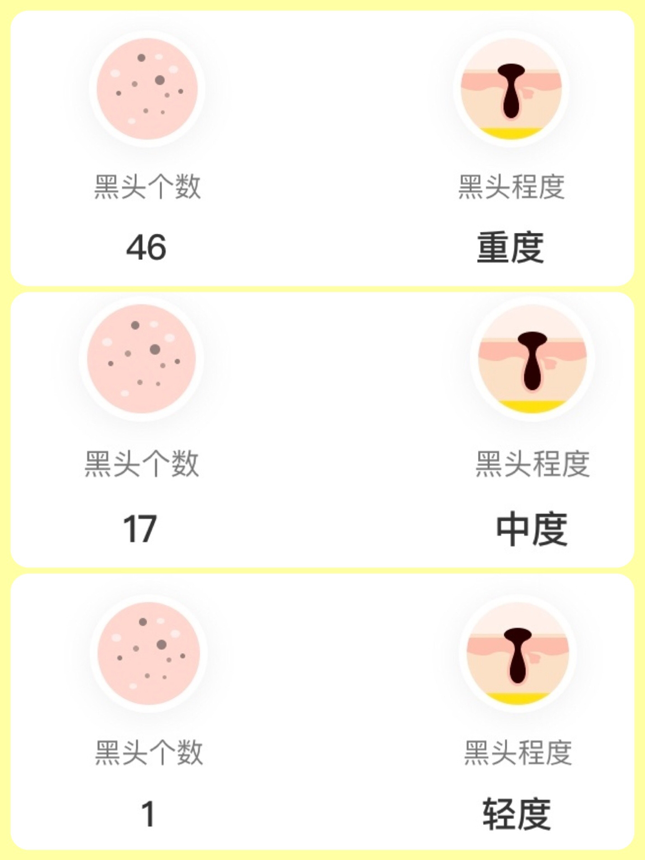 微博:王中王最准一肖100免费公开-黑头是什么