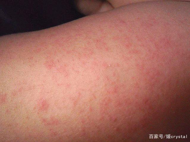 小红书:2024澳门资料正版大全-欢乐谷怎么去地铁