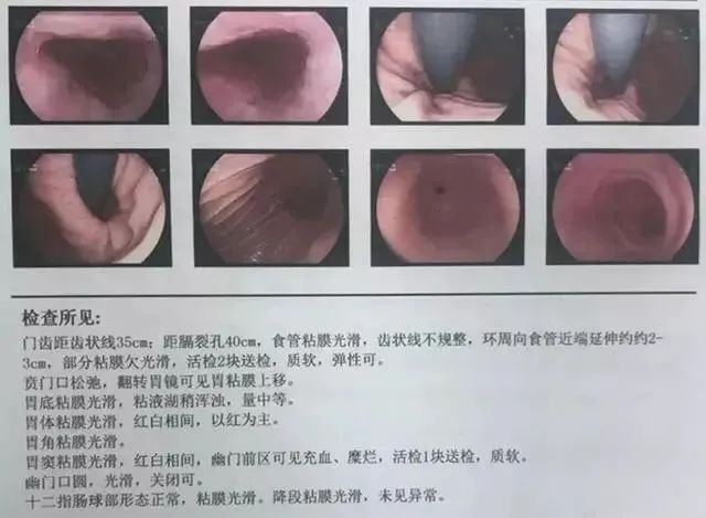 小红书:4949澳门免费资料大全特色-宫颈糜烂是什么原因引起的