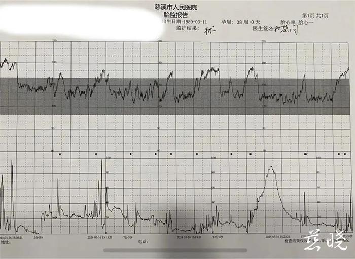 百度平台:澳门王中王100%期期中-胎心监护是检查什么