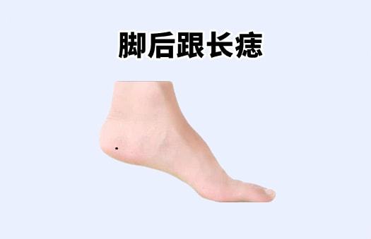 网易:2024澳门免费最精准龙门客栈-女人脚底有痣代表什么