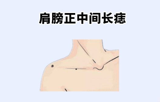 网易:2024澳门免费最精准龙门客栈-女人脚底有痣代表什么