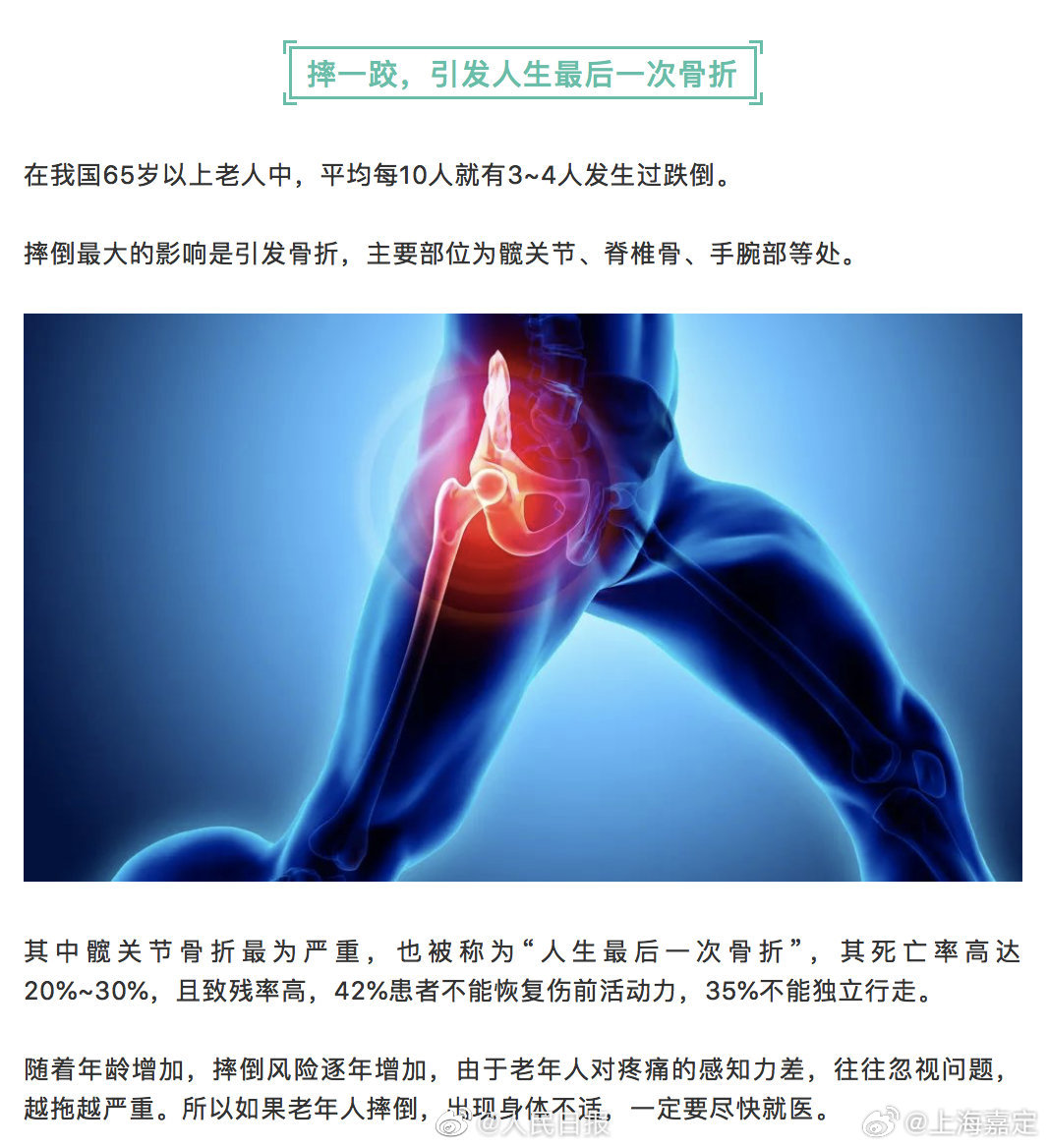 知乎：2024管家婆正版六肖料-什么睡姿对髋关节好